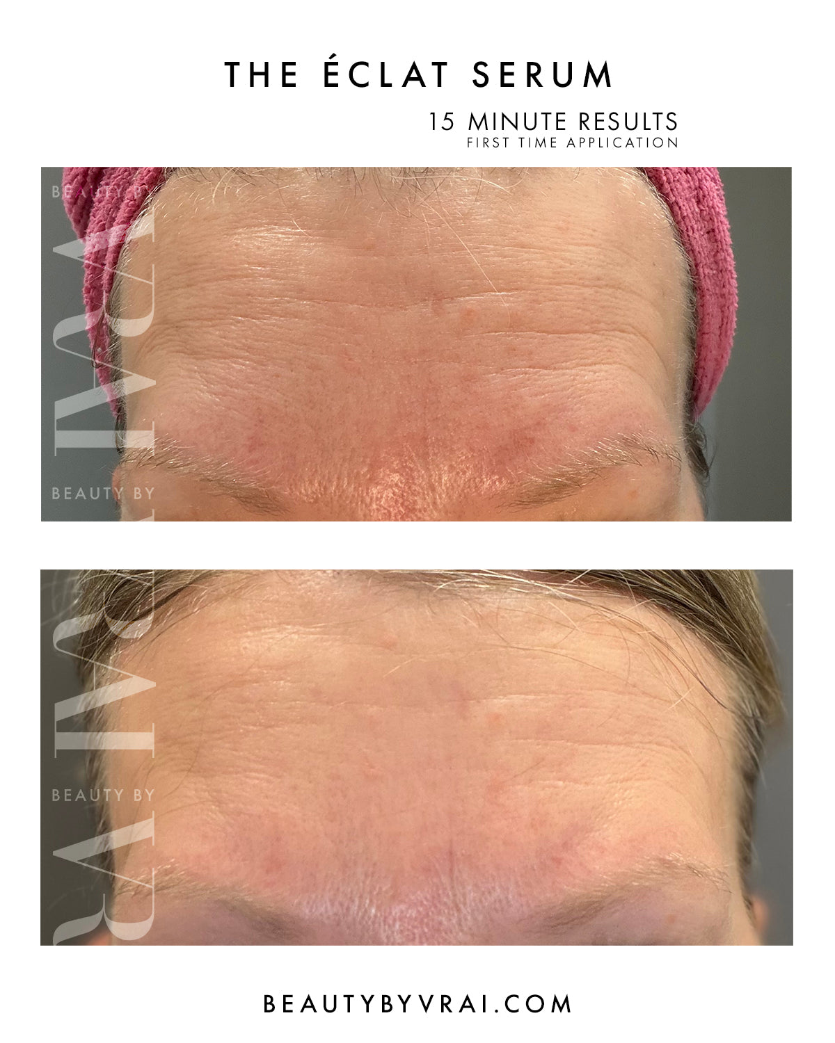 The Éclat Serum