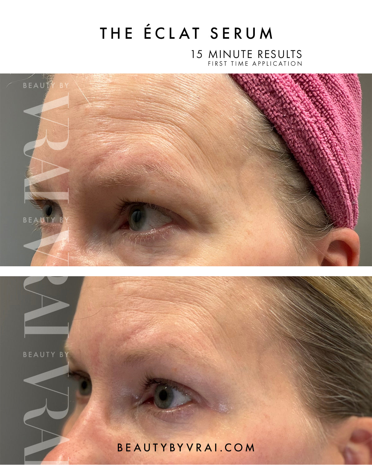 The Éclat Serum