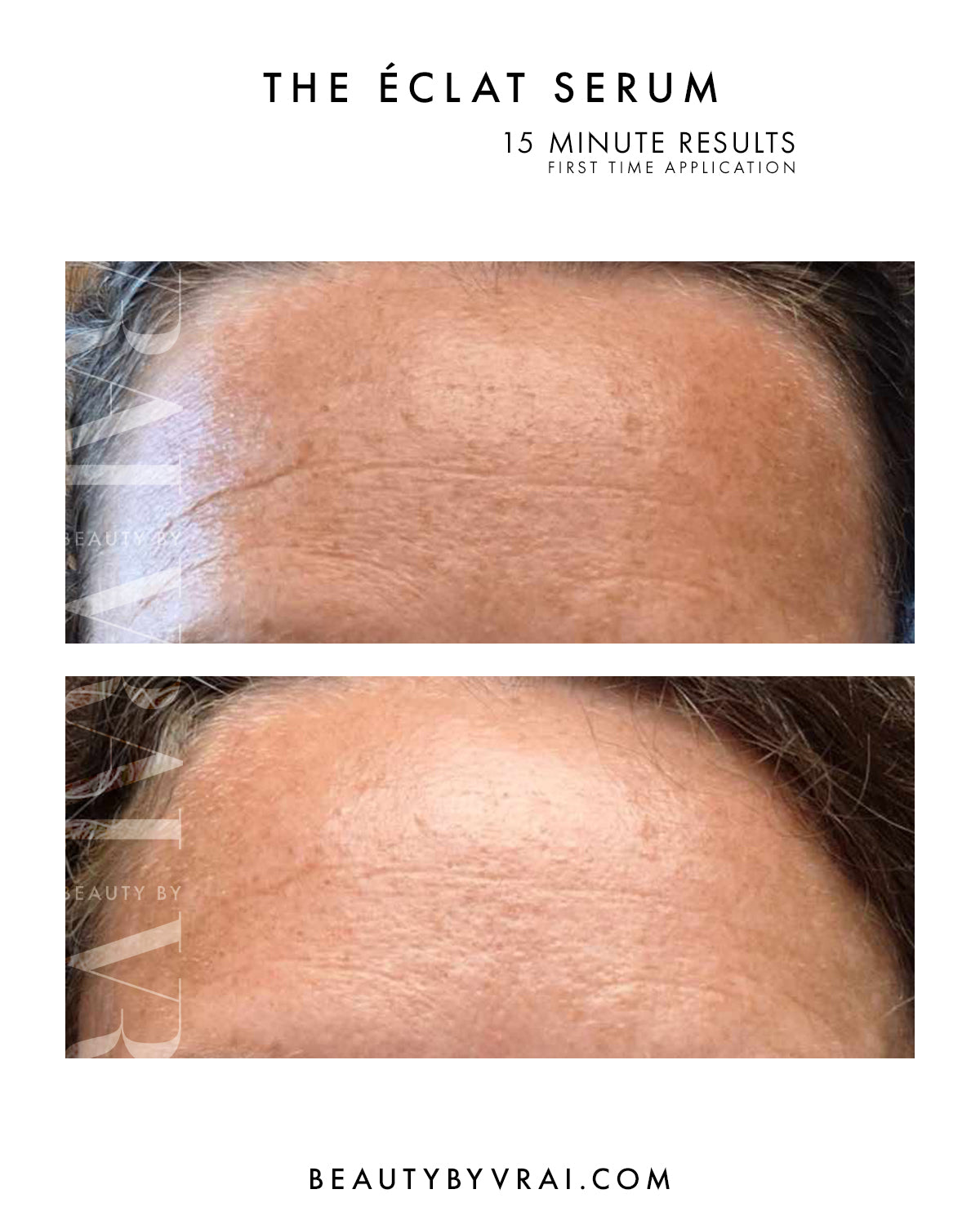 The Éclat Serum