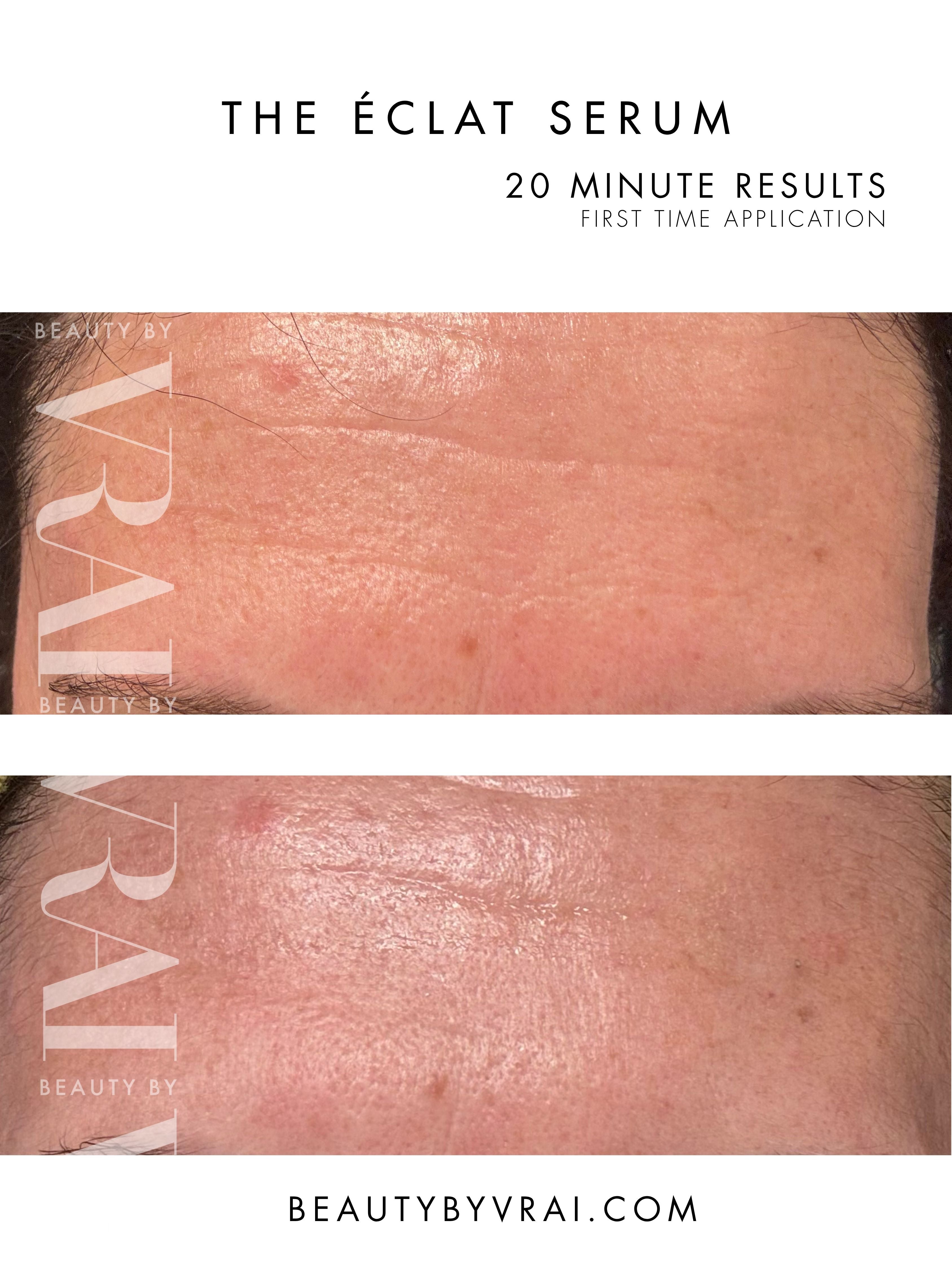The Éclat Serum