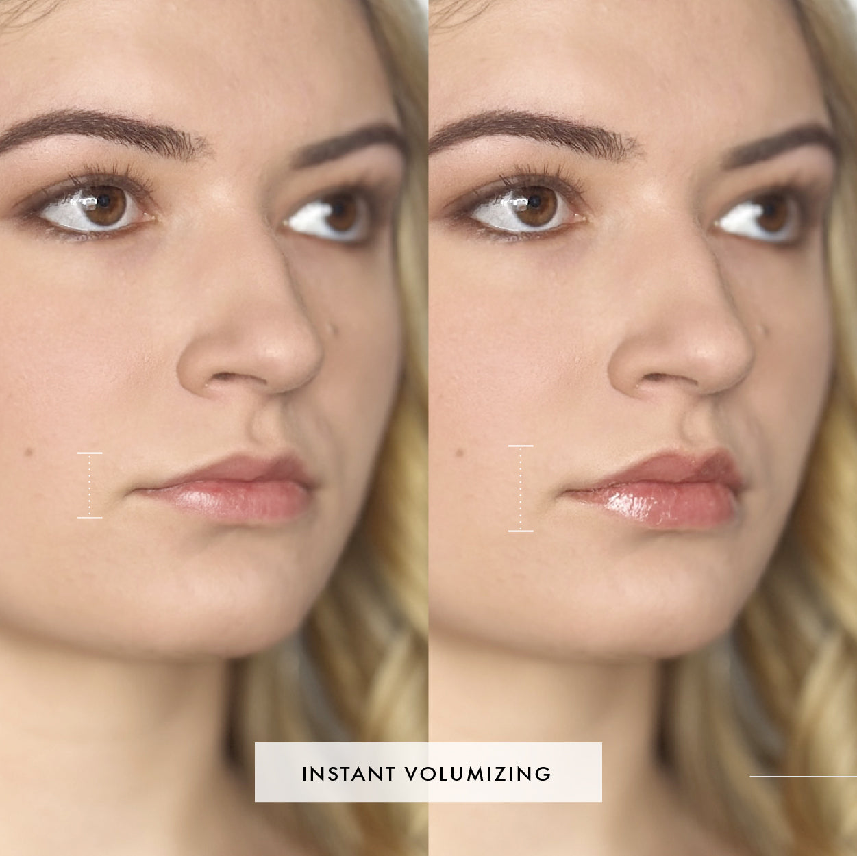 The Limitless Lip Plumper